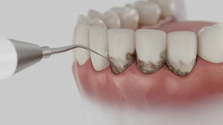Trusted Tooth Extraction service in Dover Base Housing, DE - Dentist Open Now